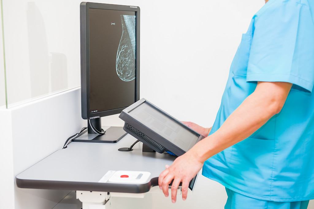 A Doctor Looking at a Computer Showing a Scan of a Woman’s Breast What Does Dense Breast Tissue Mean