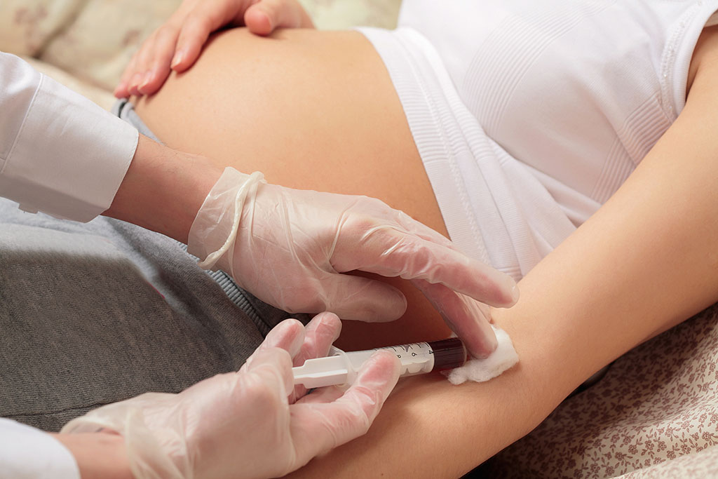 Closeup Of an Obgyn Doctor Removing A Syringe From A Pregnant Woman’s Arm During Non-Invasive Prenatal Testing